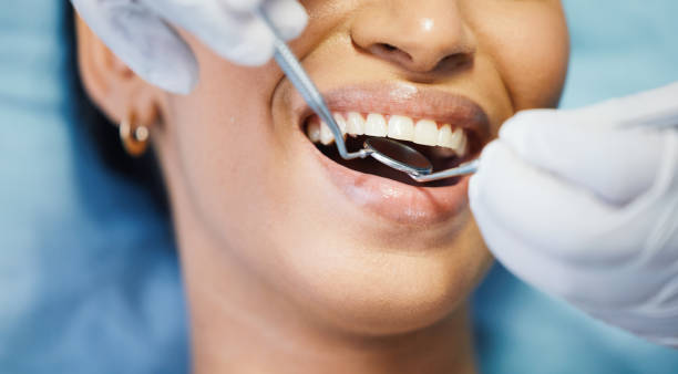 Best Broken or Cracked Tooth Emergency Dentist in Safety Harbor, FL
